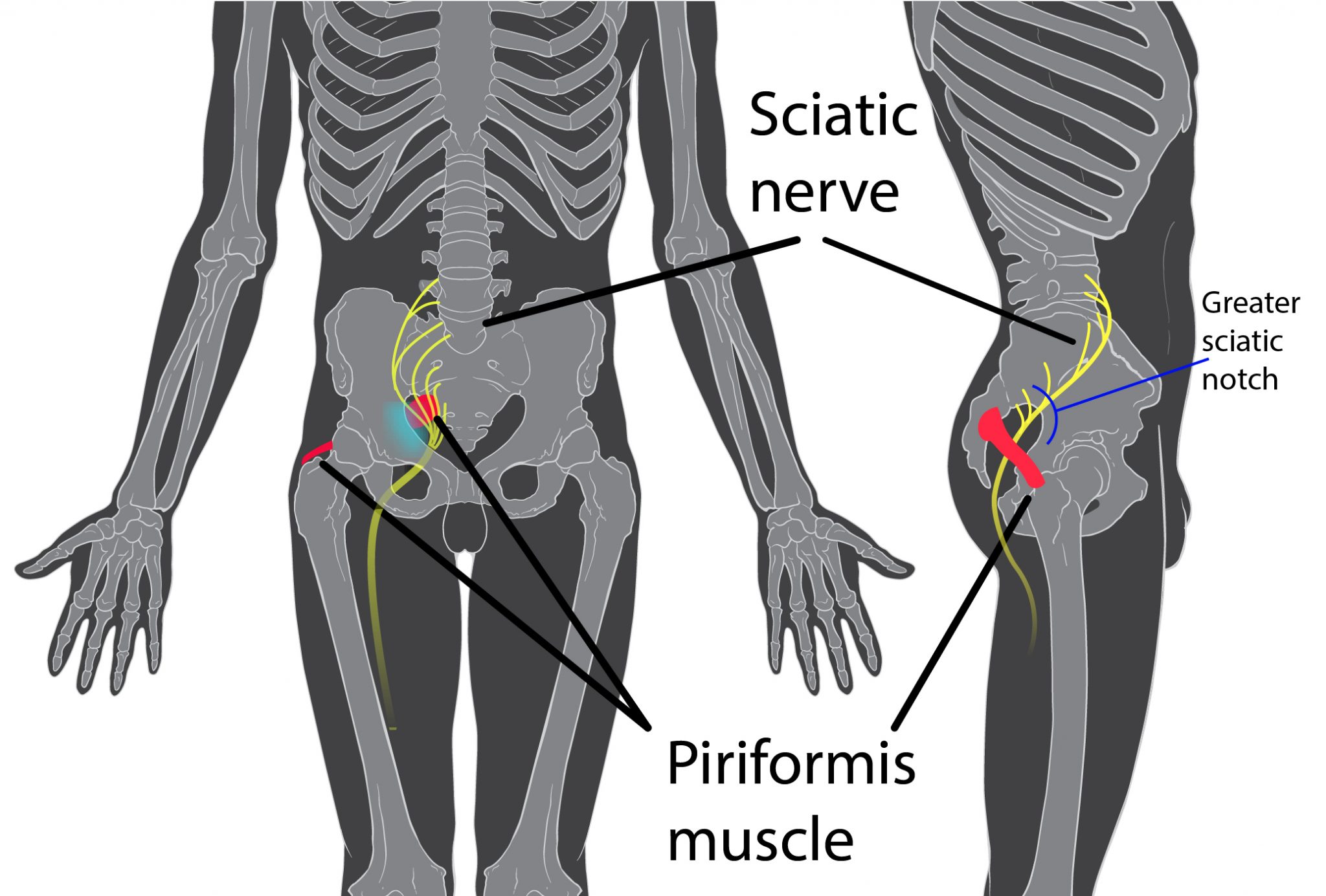 Sciatica and Low Back Pain: Are They the Same Thing? - Specialized