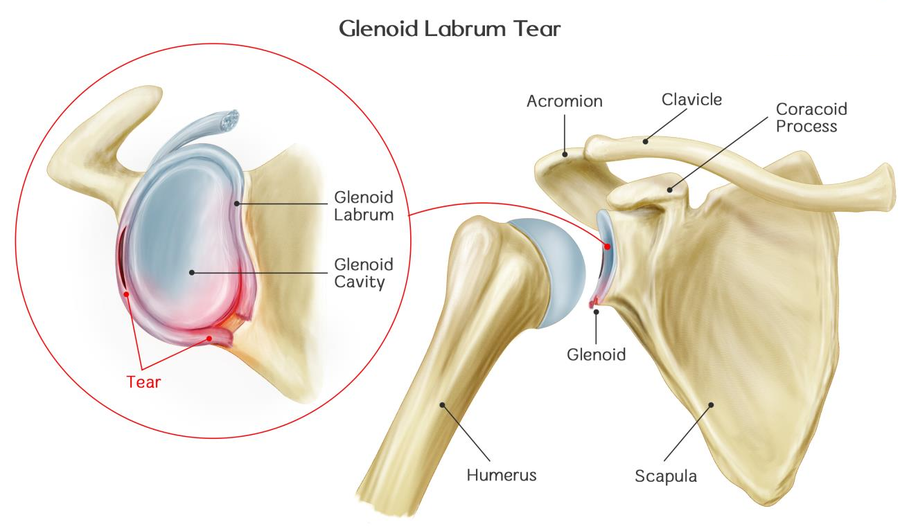 Superior labrum deals